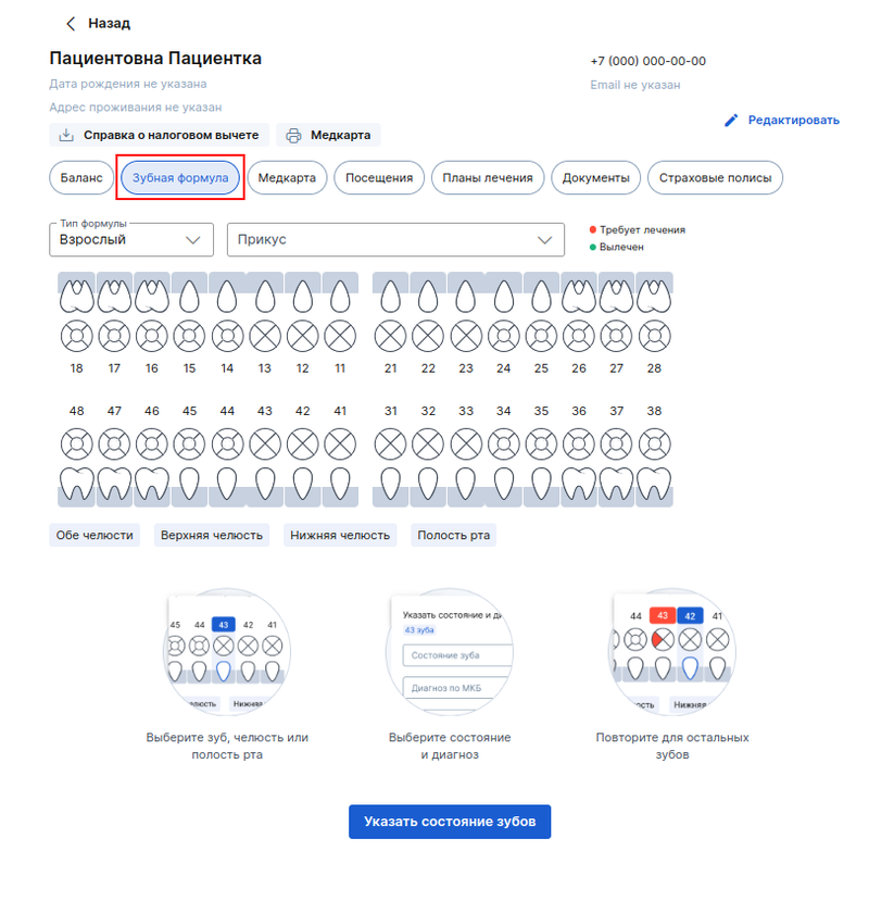 Зубная формула в профиле пациента